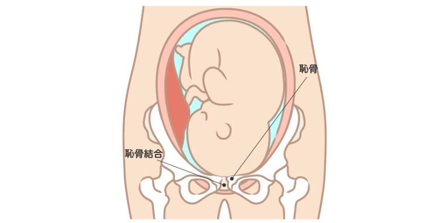 臨月の恥骨痛の原因は 助産師 出産前の歩けないくらい辛い時の対処 まなべび